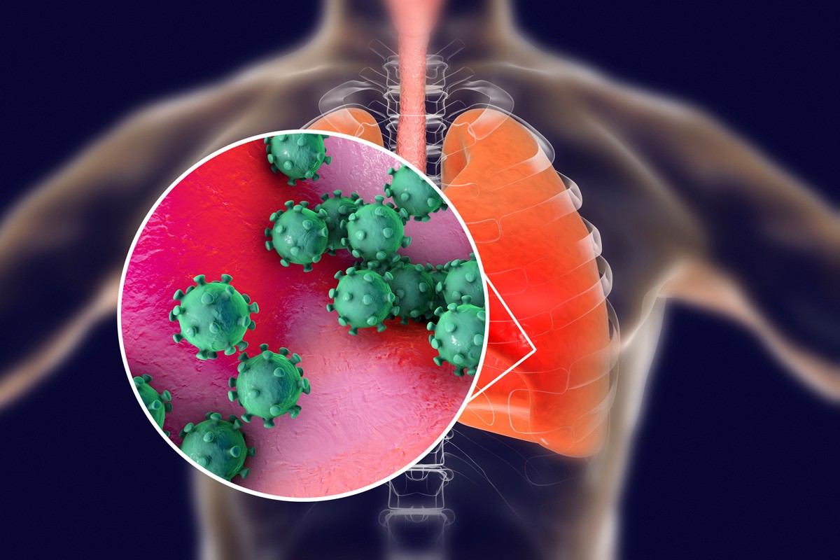 Coronavirus_site